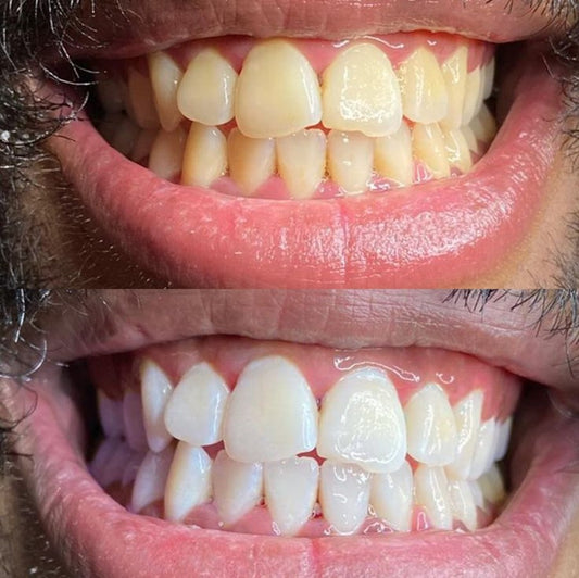 Dentex™ — Dentifrice Éclat & Blancheur